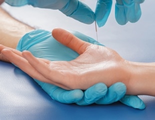 Acupuncture may help ICU patients recover faster