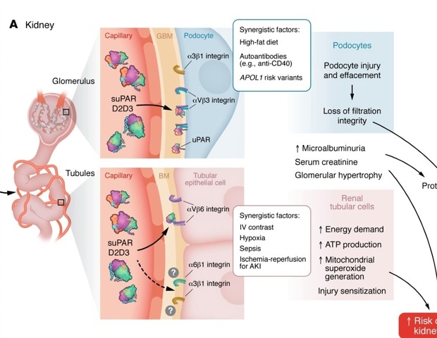 A single immune protein may help explain why kidney and heart disease often develop together