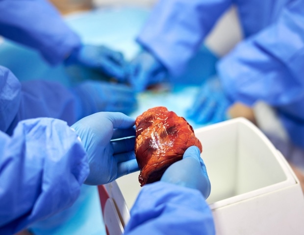 Why people donate their bodies to science