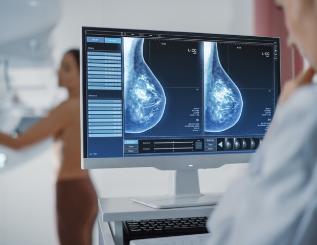 Low-dose megestrol strengthens hormone therapy in ER-positive breast cancer