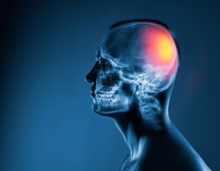 Wearable AI device turns silent throat signals into fluent speech for stroke patients