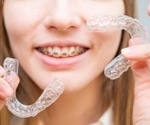 Clear aligners protect oral microbiome better than fixed braces
