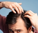 Which hair loss supplements actually work?
