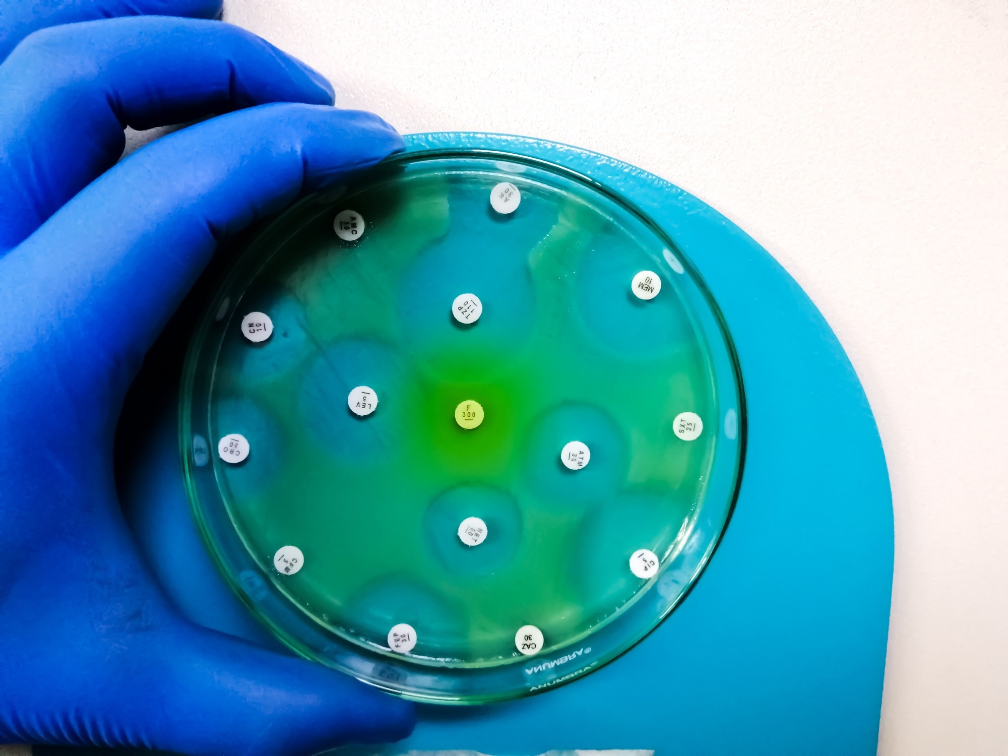 Review Calls For Global MIC Standardization