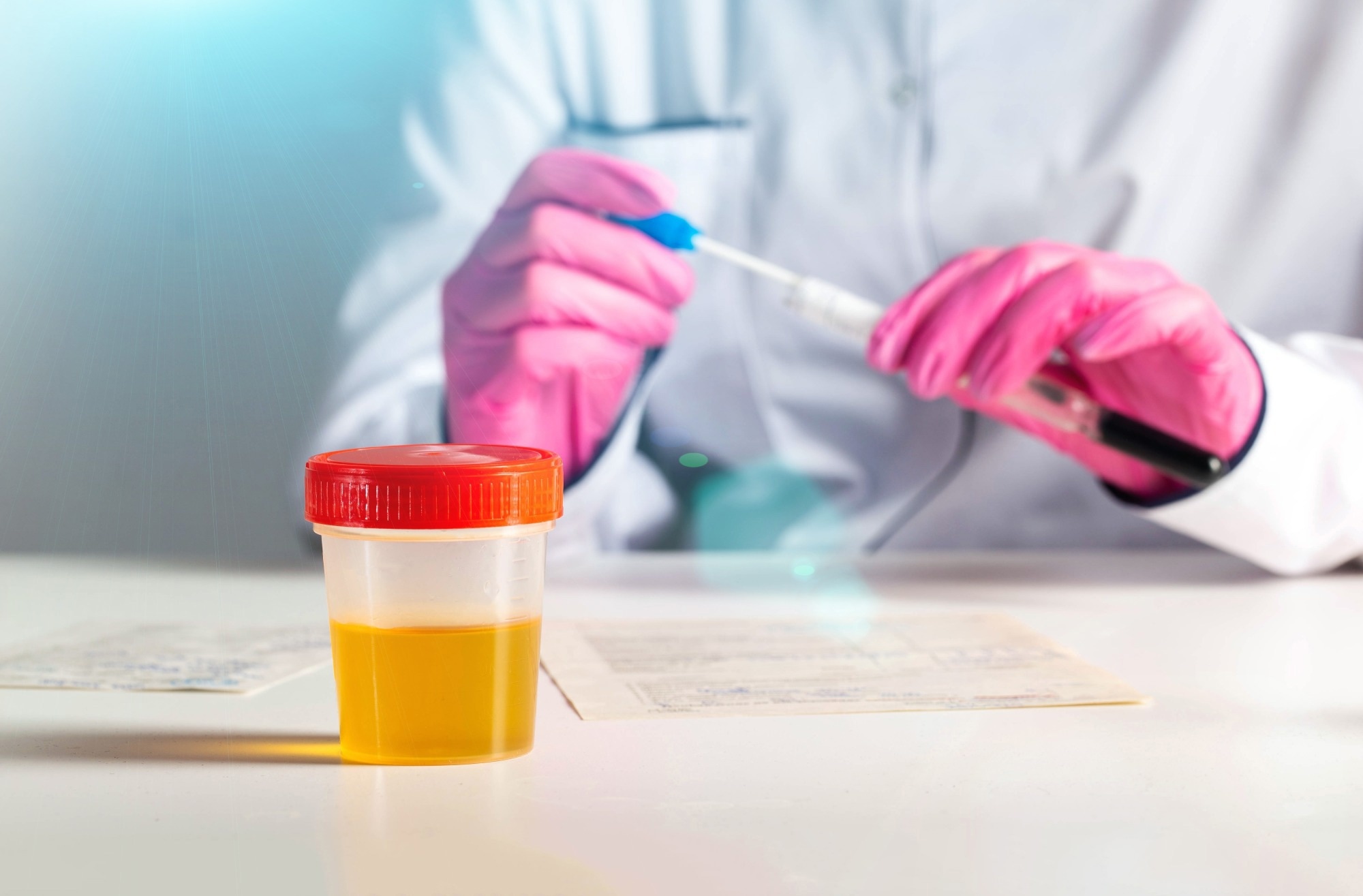 Doctor laboratory assistant in pink gloves performs research urine analysis. Concept of testing urine.