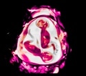 MRI scans reveal human brain growth from pregnancy through birth