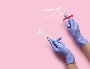 Self-collected HPV tests match clinical screening