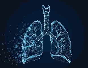 Artificial lung keeps patient alive after lung removal