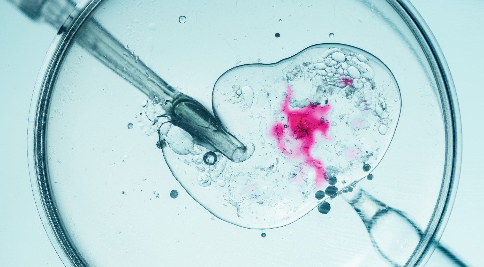 Study: Short-term vs. overnight insemination: which one is better for patients with only one or two oocytes retrieved in IVF cycles? Image Credit: Rohane Hamilton / Shutterstock