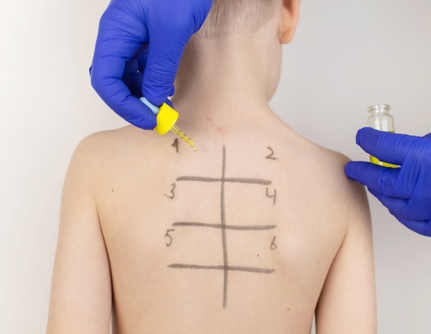 Top early-life factors driving childhood food allergy