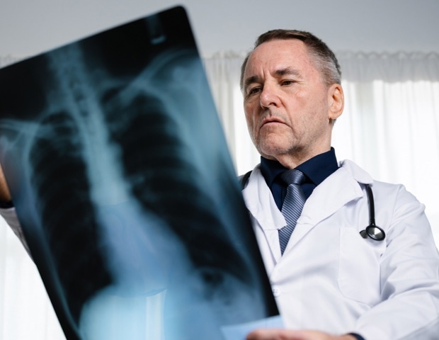 Why lung cancer in never smokers is rising and how targeted detection could reduce deaths