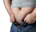 Obesity sharply increases hospitalisation risk from infections, global analysis shows