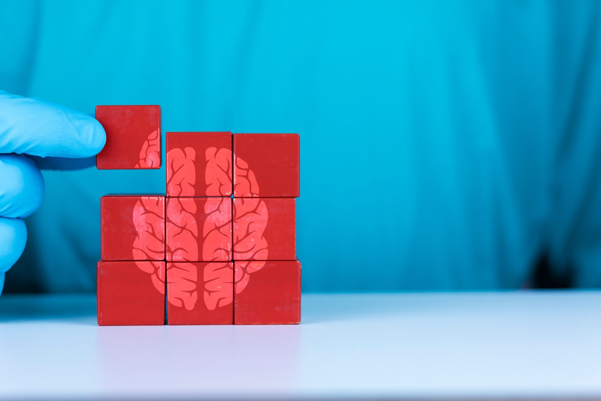 Study: The promise of GLP-1 receptor agonists for neurodegenerative diseases. Image Credit: Antonio Marca / Shutterstock