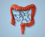 Experts identify safest and most effective diets for IBS management