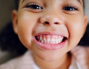 Childhood cavities and gum disease raise adult heart disease risk
