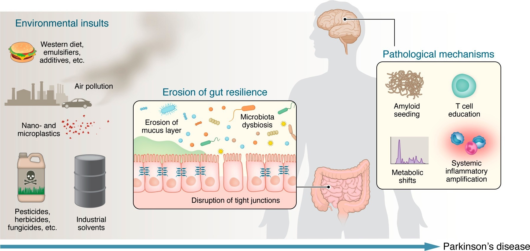 Researchers Propose That Parkinson’s Disease May Start In The Gut, Not The Brain