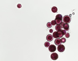 Postbiotics may help treat PCOS by restoring microbiome balance