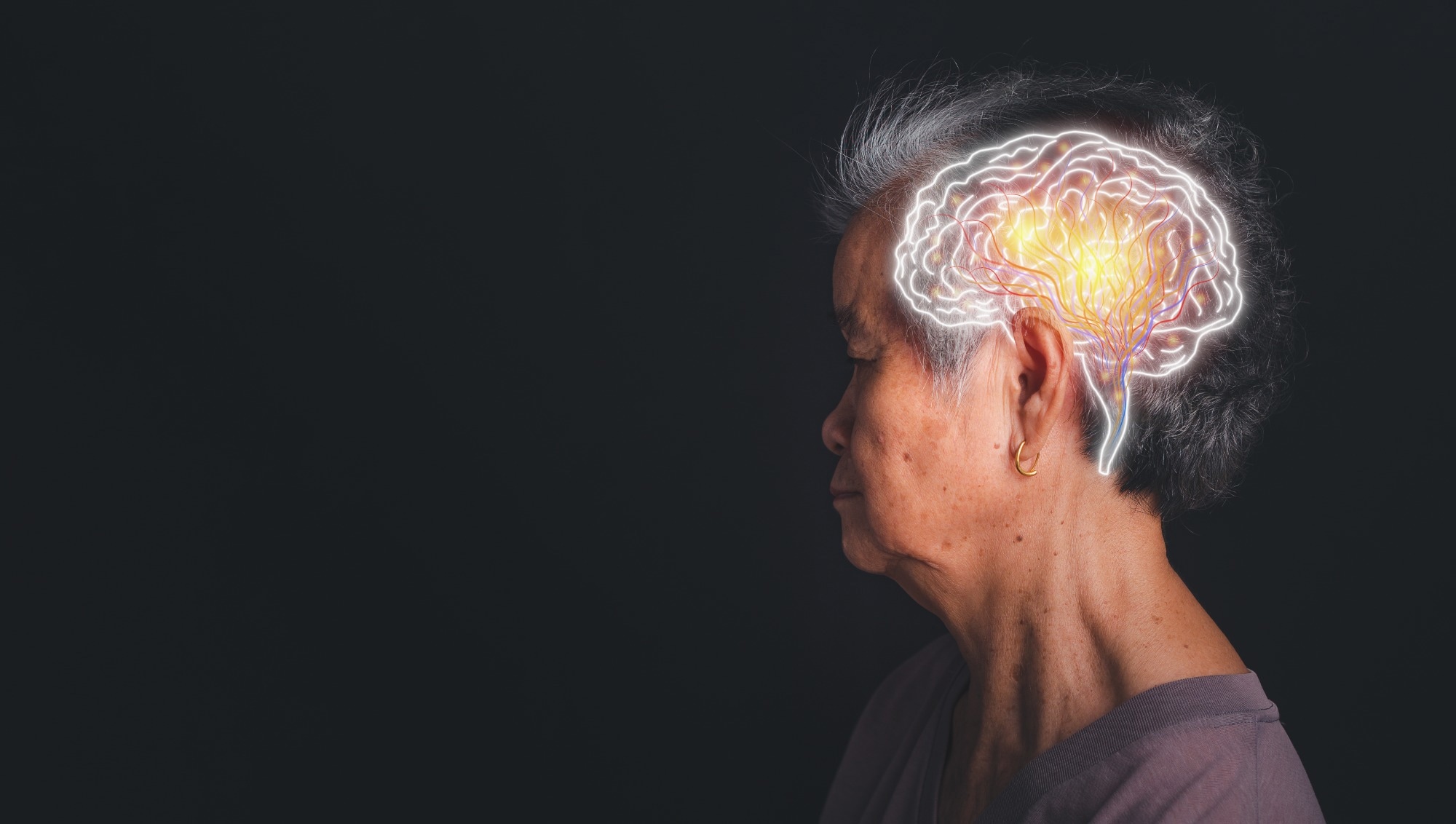 Study: Plasma Phosphorylated Tau 217 and Incident Mild Cognitive Impairment and Dementia in Older Women. Image Credit: meeboonstudio / Shutterstock