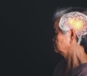 Blood test marker p-tau217 helps detect early dementia risk in cognitively healthy older women