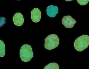 Imaris 11 transforms image analysis with automated workflows and reproducible research tools