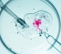Fertility treatments linked to small increases in some cancers