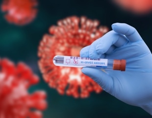 Scientists identify common symptom patterns in post-COVID-19 vaccination syndrome