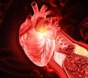 Gut-derived blood markers may help predict who develops coronary heart disease
