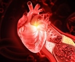 Gut-derived blood markers may help predict who develops coronary heart disease