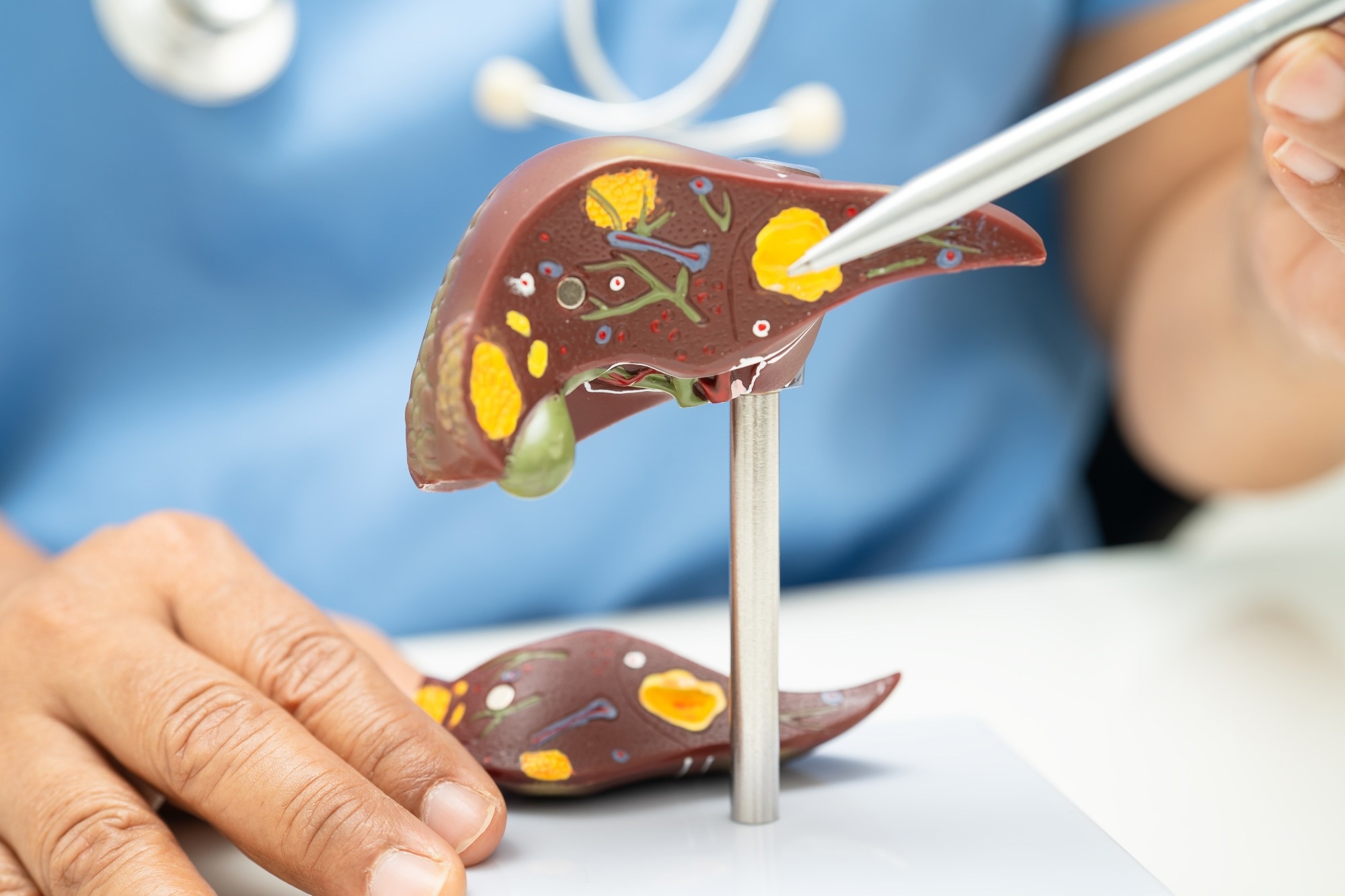 Study: Palmatine ameliorates MASLD in type 2 diabetes by modulating hepatic apoptosis and inflammation. Image Credit: sasirin pamai / Shutterstock