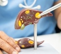 Palmatine improved fatty liver markers in a preclinical type 2 diabetes study