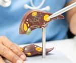 Palmatine improved fatty liver markers in a preclinical type 2 diabetes study