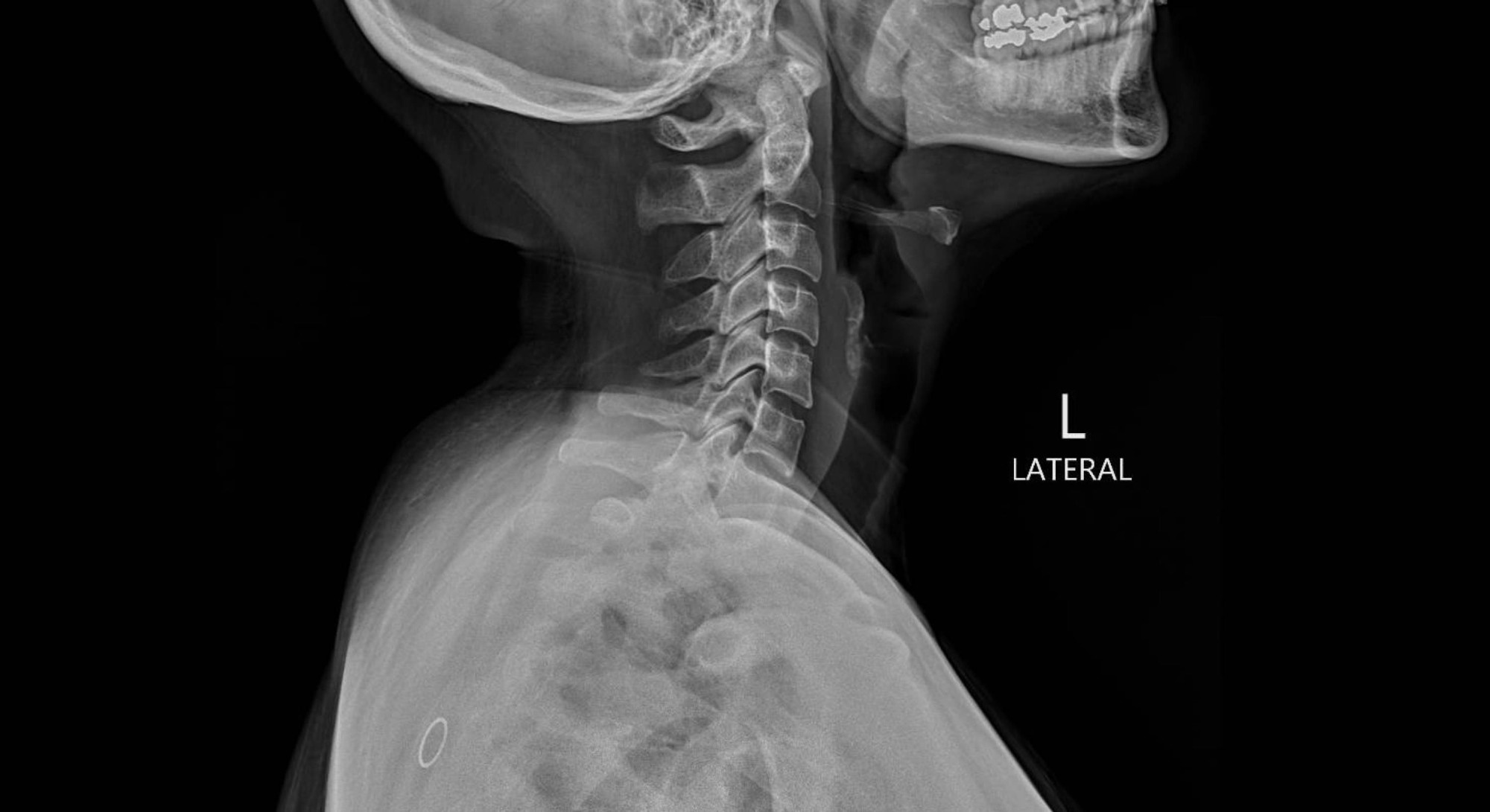 Study: The Rise of Deepfake Medical Imaging: Radiologists’ Diagnostic Accuracy in Detecting ChatGPT-generated Radiographs. Image Credit: Peter Porrini / Shutterstock