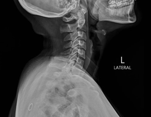 Study finds AI-generated X-rays can fool radiologists and chatbots