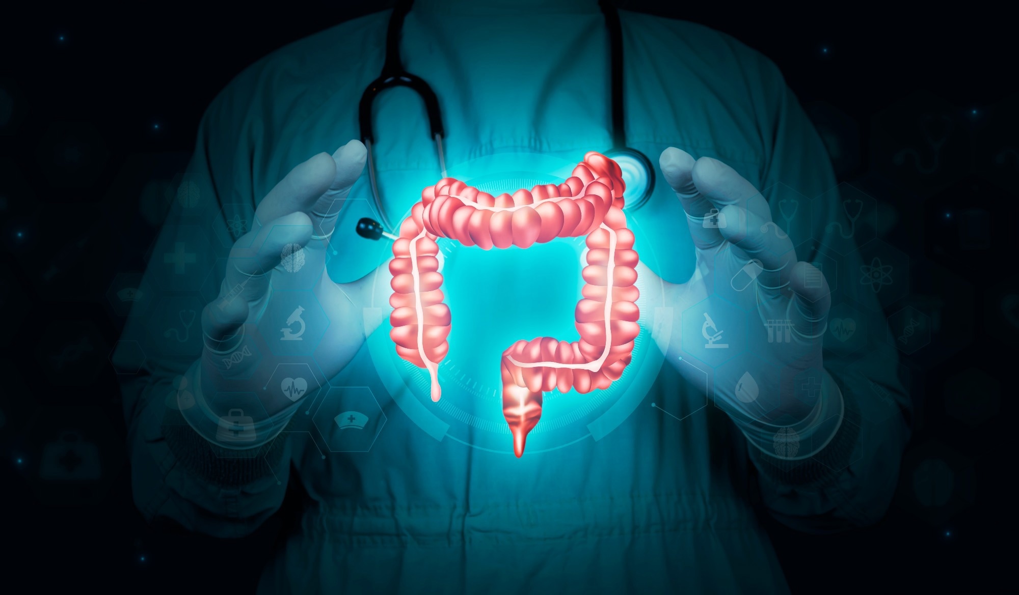 Chronic Colitis Reshapes Colon Stem Cells In Ways That Can Accelerate Tumour Growth
