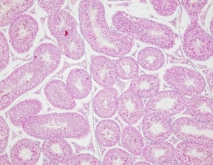 A new method to measure intracellular water in biological systems