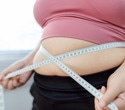 New obesity definition could delay treatment and widen health gaps