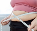 New obesity definition could delay treatment and widen health gaps
