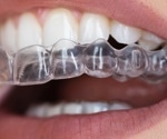 Cola may quickly lower pH inside orthodontic clear aligners and shift oral bacteria within hours