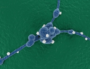 Targeted diet helps reprogram aggressive neuroblastoma in mice
