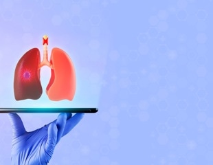 Lab study shows cigarette smoke damaged lung cells more than e-cigarette vapor