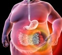 Metabolic syndrome doubles worldwide over two decades