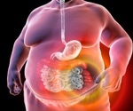Metabolic syndrome doubles worldwide over two decades