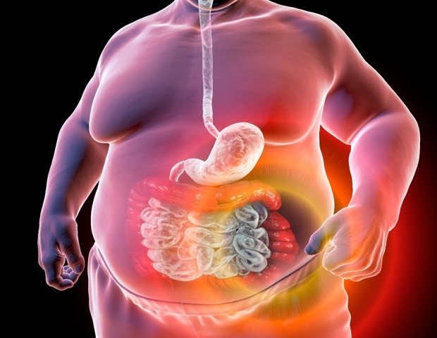 Metabolic syndrome doubles worldwide over two decades