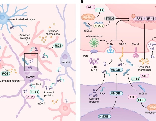 How the immune system may influence Alzheimer’s, Parkinson’s, and related diseases