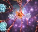 Alzheimer’s monoclonal antibodies fail to deliver meaningful results