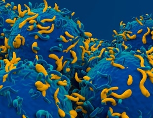 Scientists redesign CAR-T cells to fight more than cancer