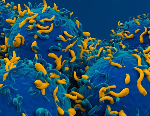 Scientists redesign CAR-T cells to fight more than cancer