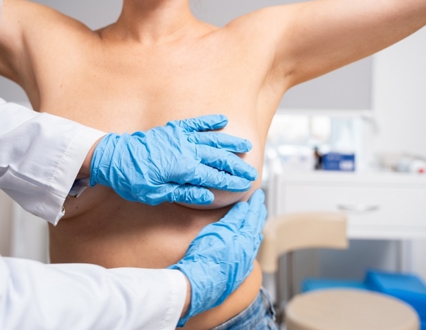 How cost, access, and awareness barriers are slowing BRCA testing