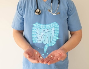 Mailed DNA-based test for colorectal cancer screening