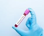 Identifying the ages when Alzheimer’s biomarkers sharply change